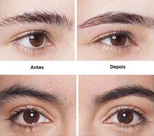 Eyebrow Easy® - Caneta Depiladora de Sobrancelhas
